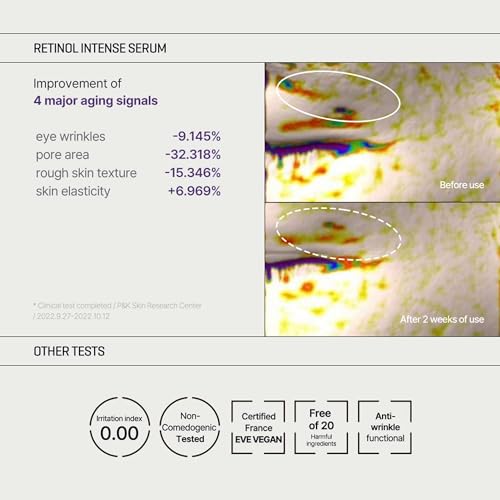 Set SOME BY MI Retinol Intense Trial Kit