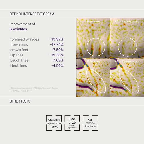 Set SOME BY MI Retinol Intense Trial Kit