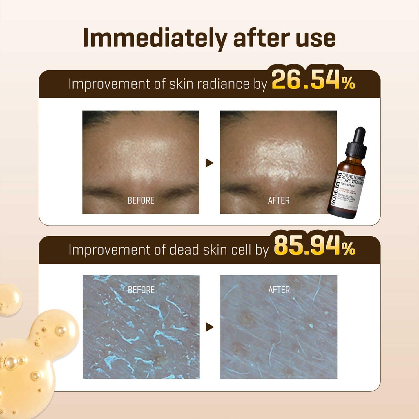 Somebymi Galactomyces Pure Vitamin C Glow Serum 30 ml