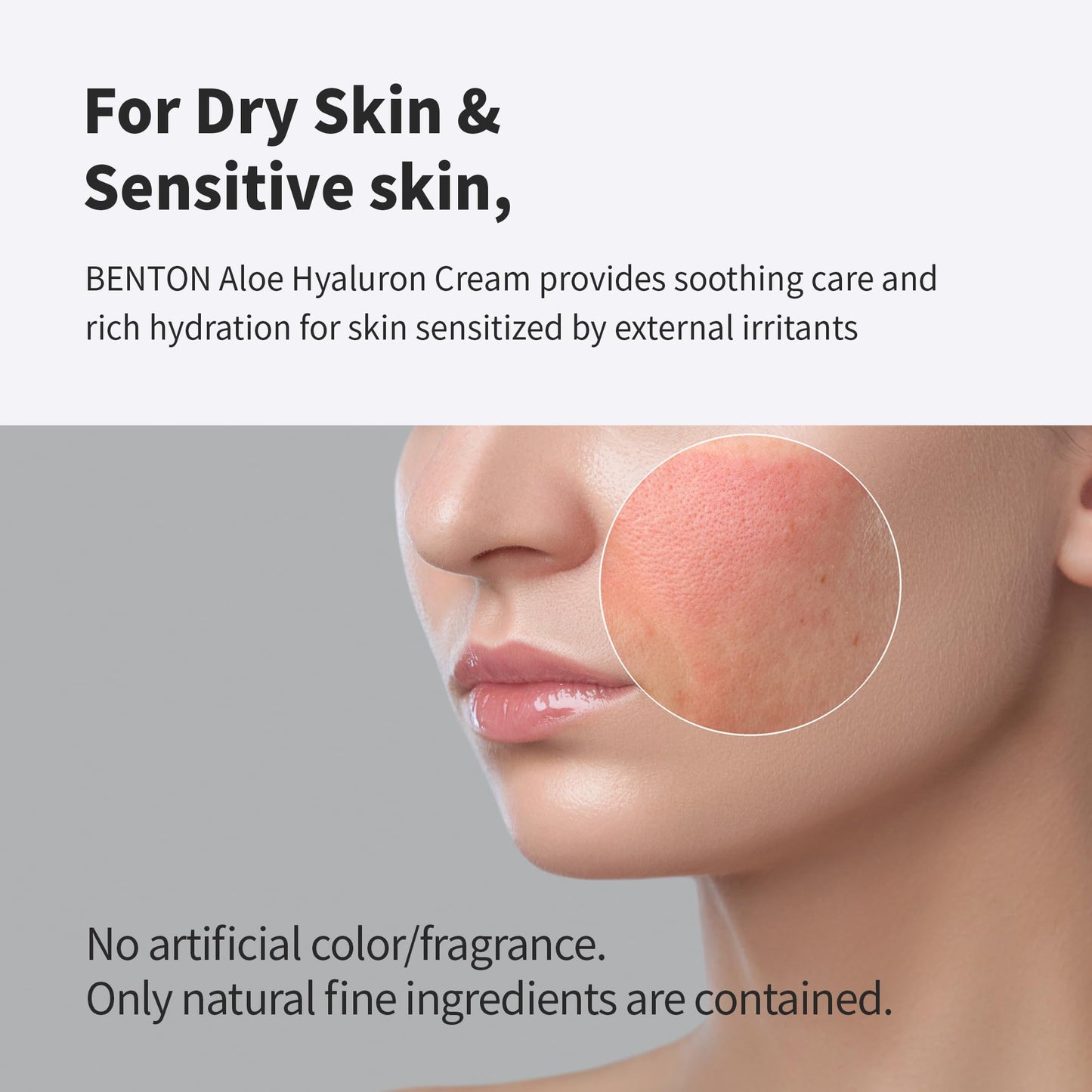 BENTON Crema de aloe de hialurón, 50 g, agua de hoja de aloe y ácido hialurónico, crema facial calmante e hidratante, para sequedad y picazón en la piel sensible