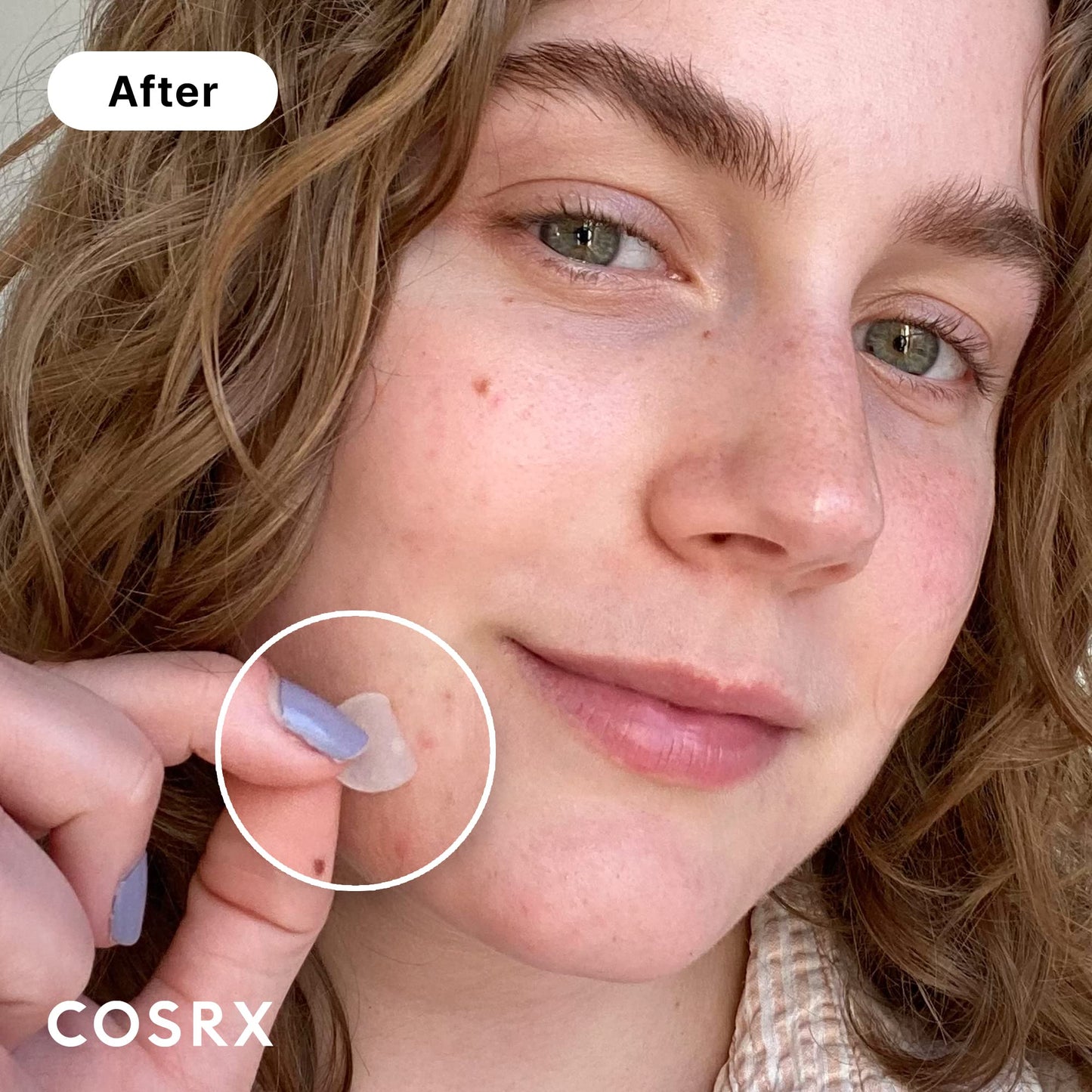 COSRX - Parche Acne Pimple Master (paquete de 3)